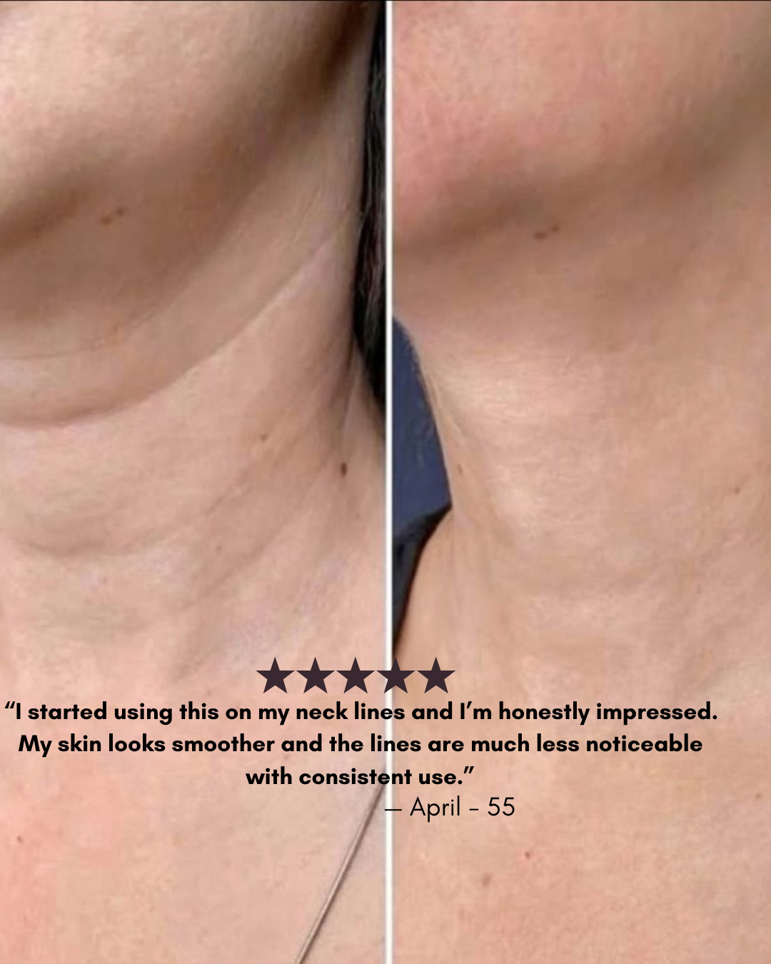 Gleama – Silikon-Narbenstift