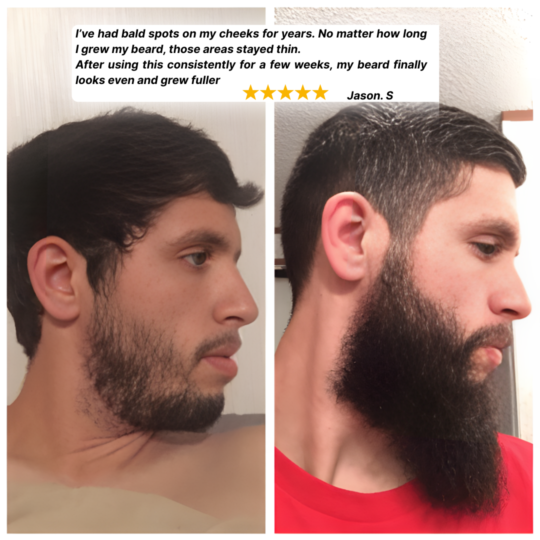 GrowEase™ | Haarwuchsserum zum Aufrollen