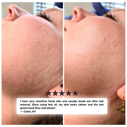 Cyperus Rotundus | Hair Minimizing Serum