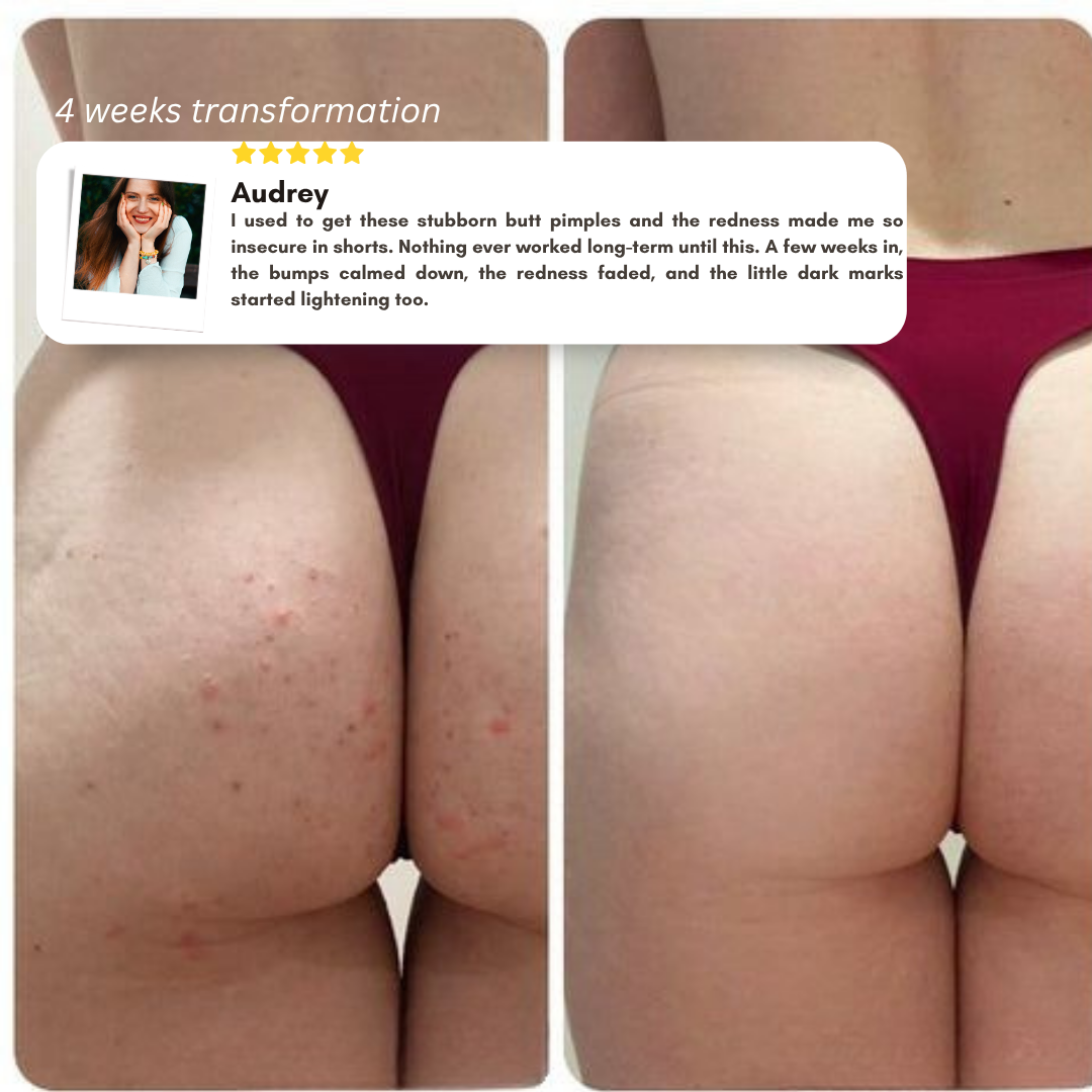 CalmaRoll | Smoothing Solution