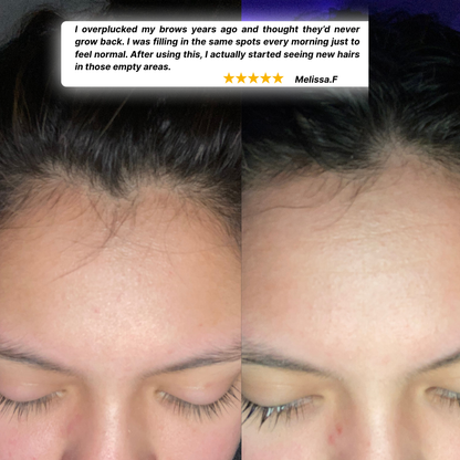 GrowEase™ Eyebrow Growth Serum