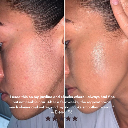 Cyperus Rotundus | Hair Minimizing Serum