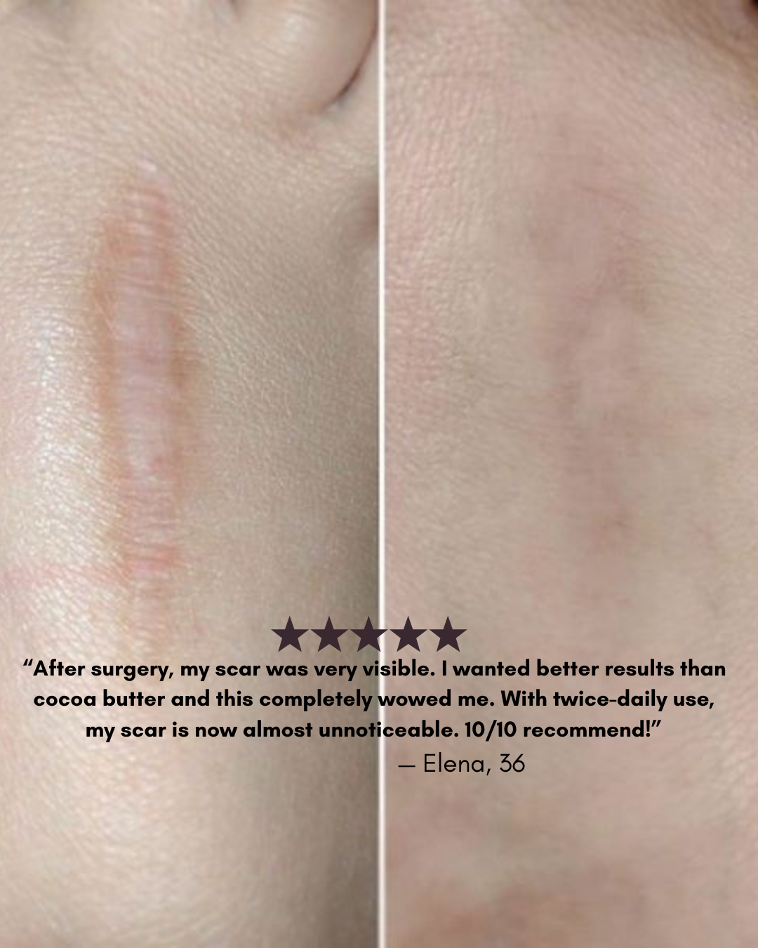 Gleama – Silikon-Narbenstift