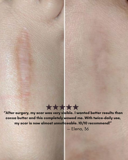 Gleama – Silikon-Narbenstift