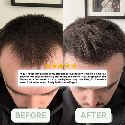 Regenx™ | Hair Growth Serum Roll-on