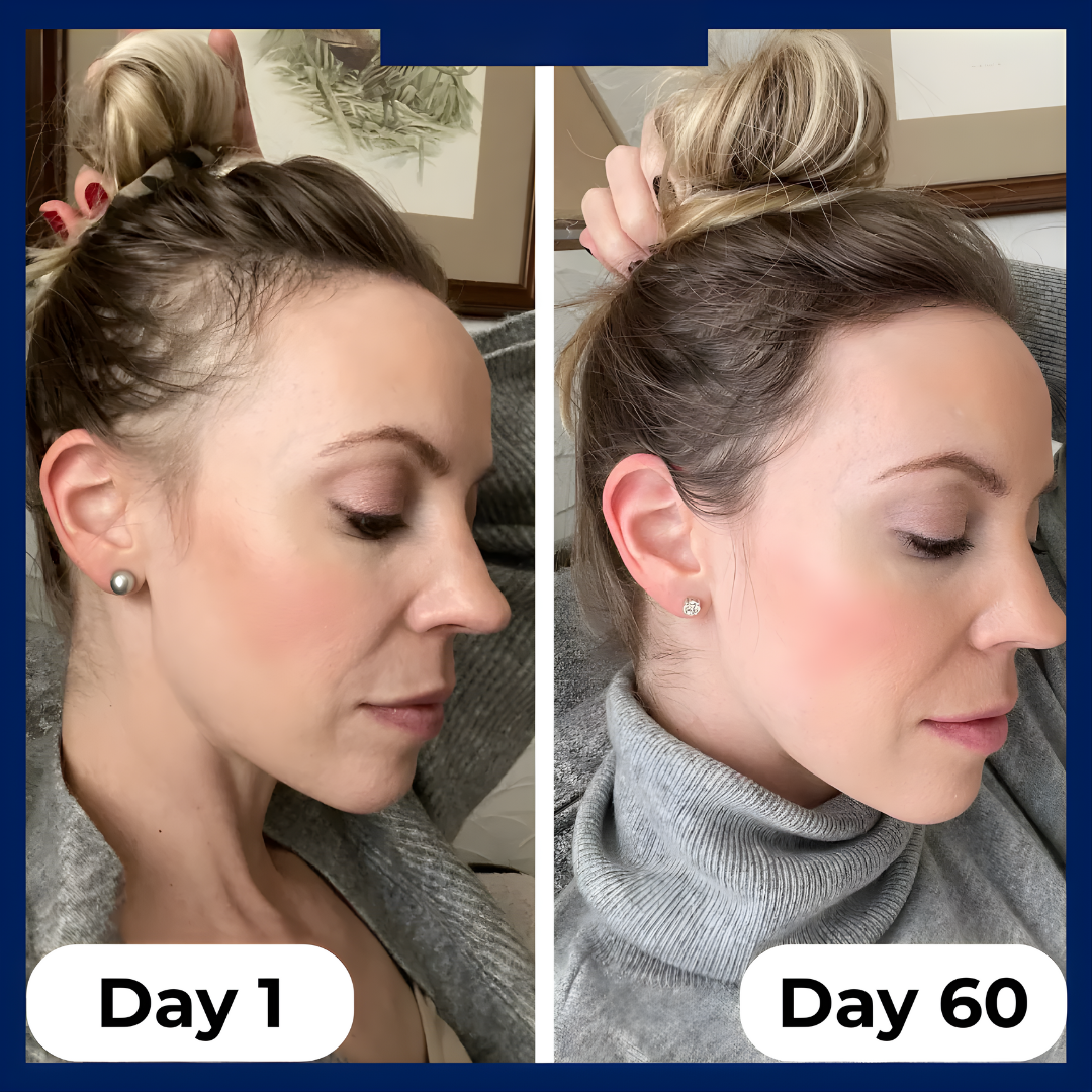 Regenx™ | Hair Growth Serum Roll-on