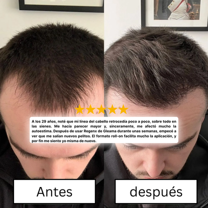 Regenx™ | Haarwuchsserum Roll-on