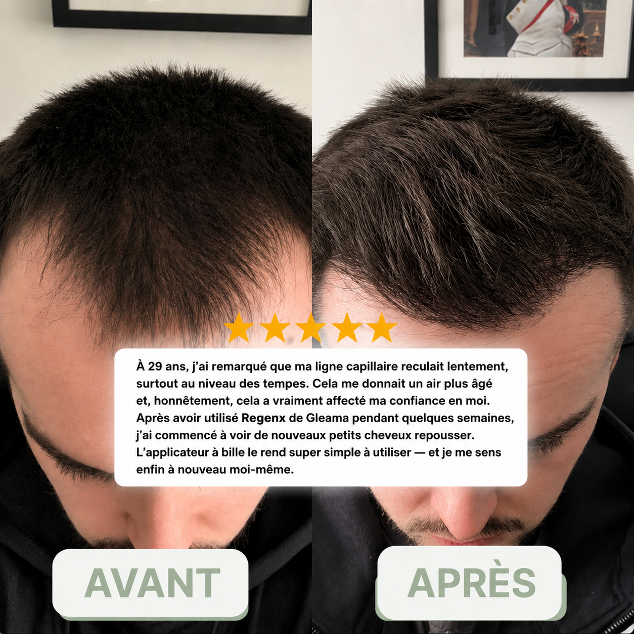 Regenx™ | Haarwuchsserum Roll-on