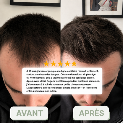 Regenx™ | Haarwuchsserum Roll-on