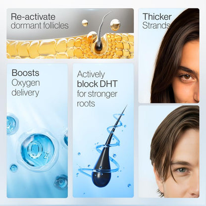 Regenx™ Hair Growth Serum Roll-on