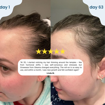 GrowEase™ Hair Growth Serum Roll-on