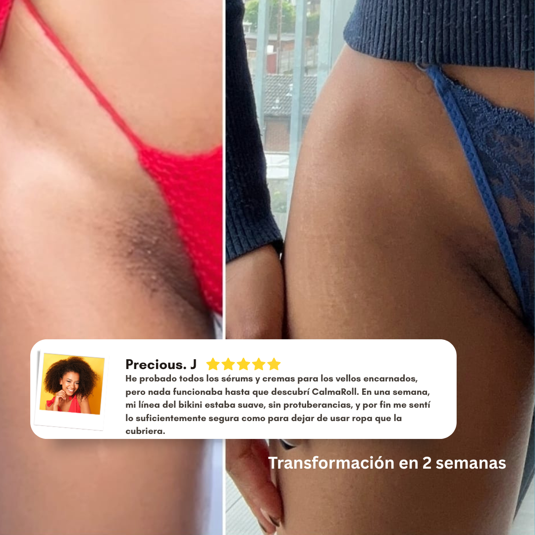 CalmaRoll | Rolle Calmante